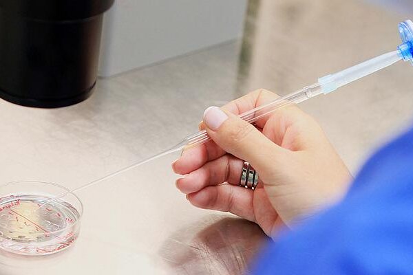 Çocuk sahibi olmak zor! Uzmanların adı, spermatozoa sayısının düşüşünde en büyük faktörü açıkladı.