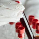 Dünyada sadece 50 kişide var! “Altın kan”ın sırrı çözüldü: Tek bir damlası bile bir servete bedel!